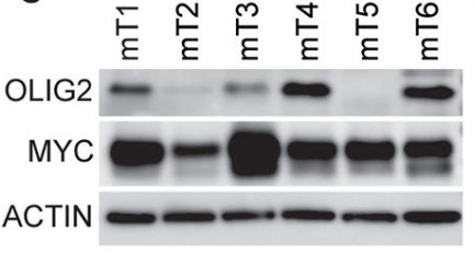 Western blot analysis of OLIG2 and MYC expression in six mouse MYC-driven MB tumors.jpg